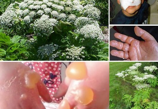 hogweed-plant1