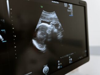 miminko ultrazvuk