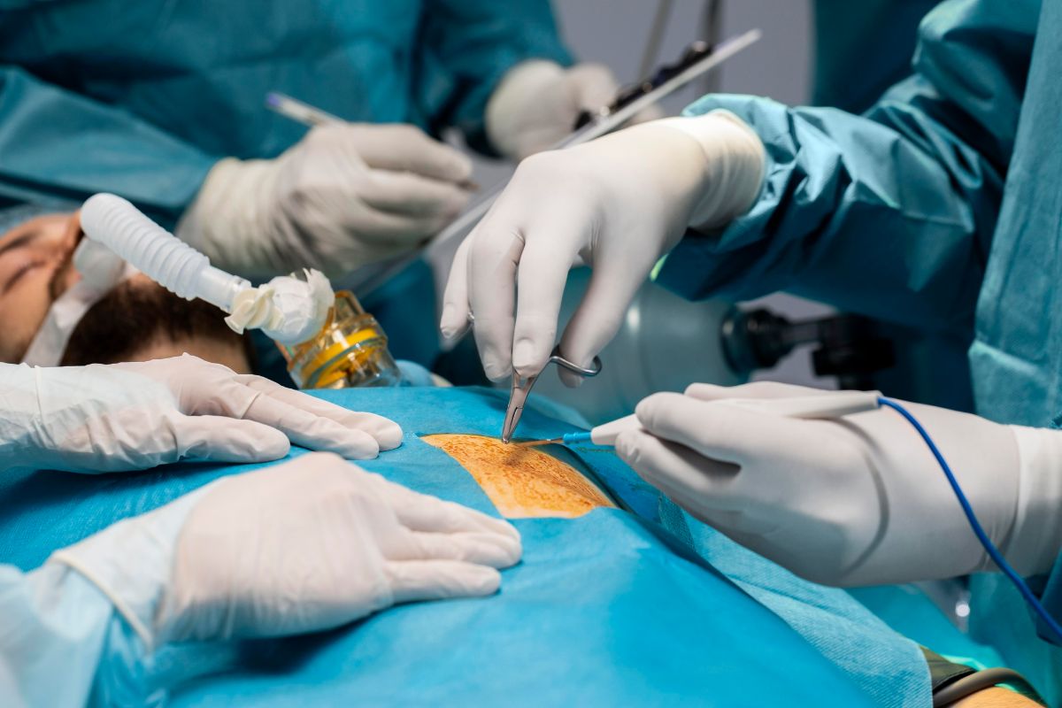 transplantace-operace