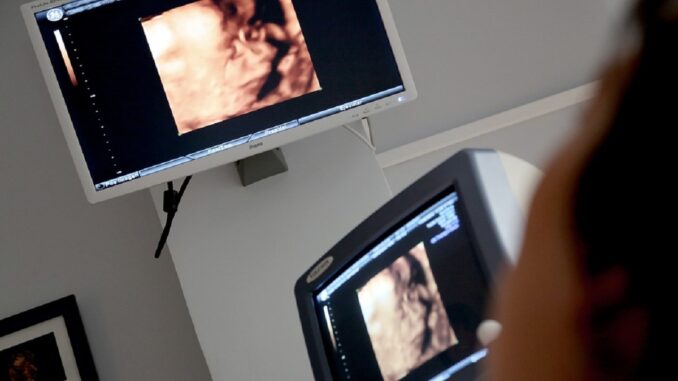 ultrazvuk v nemocnici