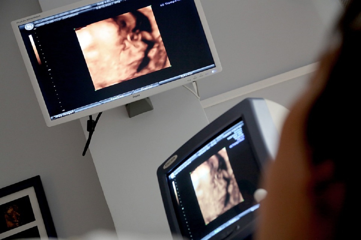 ultrazvuk-v-nemocnici